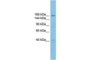 WB Suggested Anti-UBE2O Antibody Titration: 0. (UBE2O 抗体  (Middle Region))