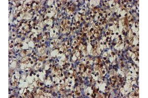 Image no. 4 for anti-NQO2 (NQO2) antibody (ABIN1499816) (NQO2 抗体)