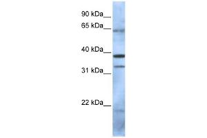 WB Suggested Anti-PCGF5 Antibody Titration:  0. (PCGF5 抗体  (N-Term))