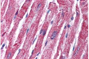 Human Heart (formalin-fixed, paraffin-embedded) stained with MAPK14 antibody ABIN214794 at 2. (MAPK14 抗体  (C-Term))