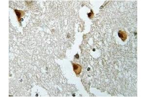 Image no. 1 for anti-Aldolase B, Fructose-Bisphosphate (ALDOB) antibody (ABIN317837) (ALDOB 抗体)