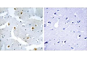 Peptide - +Immunohistochemistry analysis of paraffin-embedded human brain tissue using FMN2 antibody. (Formin 2 抗体  (Internal Region))