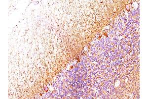 Formalin-fixed, paraffin-embedded human Cerebellum stained with Neurofilament Monoclonal Antibody (RT-97 + NR-4). (NEFH & NEFL 抗体)