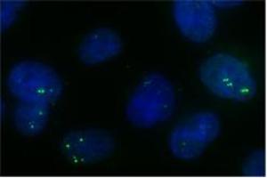 Sample Type: subnuclear bodies-paraspeckles (NONO 抗体  (C-Term))