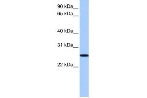 WB Suggested Anti-FBXO36 Antibody Titration: 0. (FBXO36 抗体  (N-Term))
