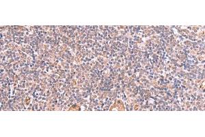 Immunohistochemistry of paraffin-embedded Human tonsil tissue using LMCD1 Polyclonal Antibody at dilution of 1:100(x200) (LMCD1 抗体)