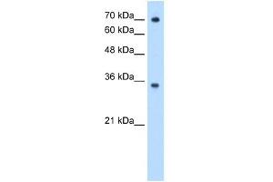 FCGRT antibody used at 0. (FcRn 抗体  (N-Term))