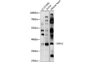 Western blot analysis of extracts of various cell lines, using SPRY2 antibody  at 1:1000 dilution. (SPRY2 抗体  (AA 1-100))