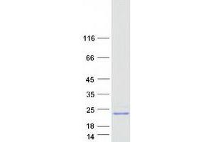 Mitotic Spindle Organizing Protein 2B (MZT2B) protein (Myc-DYKDDDDK Tag)