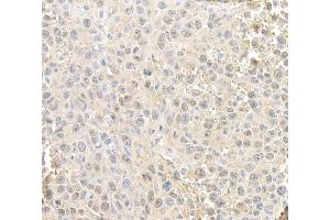 Immunohistochemistry (IHC) image for anti-RAN, Member RAS Oncogene Family (RAN) (AA 166-216) antibody (ABIN7455018) (RAN 抗体  (AA 166-216))
