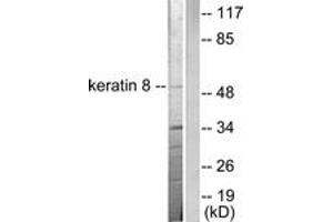 Western blot analysis of extracts from SKOV3 cells, using Keratin 8 Antibody. (KRT8 抗体  (AA 434-483))