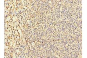 Immunohistochemistry of paraffin-embedded human tonsil tissue using ABIN7171457 at dilution of 1:100 (LY9 抗体  (AA 160-360))