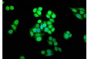Immunofluorescence staining of PC-3 cells with ABIN7169503 at 1:166, counter-stained with DAPI. (SHARPIN 抗体  (AA 82-171))
