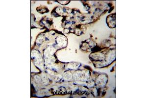 Immunohistochemistry (Paraffin-embedded Sections) (IHC (p)) image for anti-DnaJ (Hsp40) Homolog, Subfamily B, Member 11 (DNAJB11) (AA 63-92), (N-Term) antibody (ABIN656552)