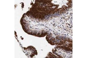 Immunohistochemical staining of human gallbladder with CKAP4 polyclonal antibody  shows distinct cytoplasmic positivity in glandular cells. (CKAP4 抗体  (AA 411-520))