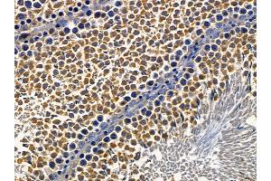 ABIN6257500 and ABIN6274303 at 1/100 staining rat testis tissue by IHC-P. (ST5 抗体  (Internal Region))