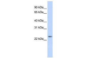 RAB8A antibody (70R-10557) used at 0. (RAB8A 抗体  (Middle Region))