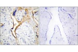 Immunohistochemistry analysis of paraffin-embedded human placenta tissue, using CKI-epsilon Antibody. (CK1 epsilon 抗体  (AA 276-325))