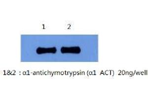 Western Blotting (WB) image for anti-serpin Peptidase Inhibitor, Clade A (Alpha-1 Antiproteinase, Antitrypsin), Member 3 (SERPINA3) antibody (ABIN1105305) (SERPINA3 抗体)