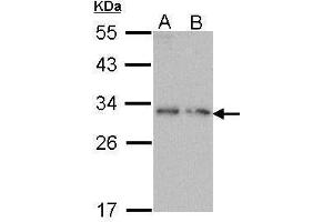 WB Image Sample (30 ug of whole cell lysate) A: Molt-4 , B: Raji 12% SDS PAGE antibody diluted at 1:1000 (PDYN 抗体)