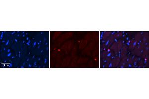 Rabbit Anti-Ppara Antibody  Catalog Number: ARP34068_P050 Formalin Fixed Paraffin Embedded Tissue: Human Adult heart  Observed Staining: Nuclear Primary Antibody Concentration: 1:600 Secondary Antibody: Donkey anti-Rabbit-Cy2/3 Secondary Antibody Concentration: 1:200 Magnification: 20X Exposure Time: 0. (PPARA 抗体  (C-Term))