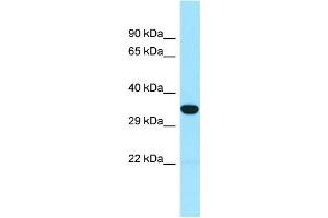 WB Suggested Anti-SNX15 Antibody Titration: 1. (SNX15 抗体  (N-Term))