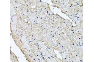 Immunohistochemistry of paraffin-embedded Rat heart using USH1C Polyclonal Antibody at dilution of 1:100 (40x lens). (USH1C 抗体)