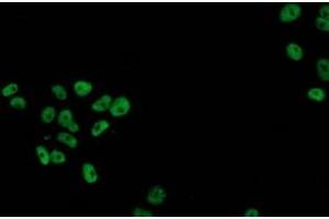 Anti-TP53 mouse monoclonal antibody (ABIN2454590) immunofluorescent staining of COS7 cells transiently transfected by pCMV6-ENTRY TP53 (RC200003). (p53 抗体)