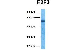 Host:  Rabbit  Target Name:  E2F3  Sample Tissue:  Human Ovary Tumor  Antibody Dilution:  1.