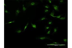 Immunofluorescence (IF) image for anti-AP2 associated kinase 1 (AAK1) (AA 315-415) antibody (ABIN524804)