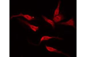 ABIN6276010 staining NIH-3T3 by IF/ICC. (GPR135 抗体  (Internal Region))