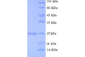SDS-PAGE (SDS) image for HRas proto-oncogene, GTPase (HRAS) (AA 2-186) protein (His tag) (ABIN5712980)