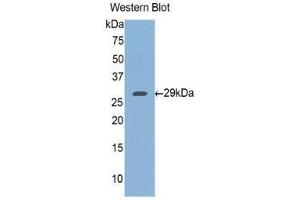 Western Blotting (WB) image for anti-FK506 Binding Protein 8, 38kDa (FKBP8) (AA 93-339) antibody (ABIN1078046)