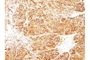 anti-MLANA & SILV antibody