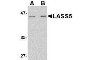 Image no. 1 for anti-LAG1 Homolog, Ceramide Synthase 5 (LASS5) (N-Term) antibody (ABIN342684) (LASS5 抗体  (N-Term))