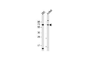All lanes : Anti-CYP2B6 Antibody (Center) at 1:2000 dilution Lane 1: 293 whole cell lysate Lane 2: Jurkat whole cell lysate Lysates/proteins at 20 μg per lane. (CYP2B6 抗体  (AA 235-263))