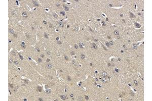 ABIN6257961 and ABIN6274900 at 1/100 staining rat liver tissue by IHC-P. (BOK 抗体  (N-Term))