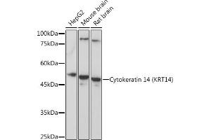 Western blot analysis of extracts of various cell lines, using Cytokeratin 14 (Cytokeratin 14 (KRT14)) Rabbit pAb (ABIN7268092) at 1:5000 dilution. (KRT14 抗体  (C-Term))