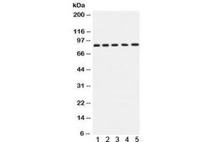 Western blot testing of 1) rat brain, 2) rat testis, 3) human SGC-7901, 4) 22RV1 and 5) MCF7 lysate with APLP1 antibody. (APLP1 抗体)