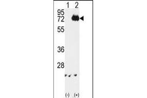 Western blot analysis of IKKalpha (arrow) using rabbit polyclonal IKKalpha Antibody (ABIN6243793 and ABIN6579033). (IKK alpha 抗体)