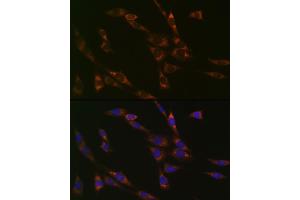 Immunofluorescence analysis of NIH-3T3 cells using RPS3 Rabbit mAb (ABIN7270025) at dilution of 1:100 (40x lens). (RPS3 抗体)