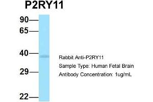 Host: Rabbit  Target Name: P2RY11  Sample Tissue: Human Fetal Brain  Antibody Dilution: 1.
