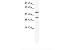 Image no. 1 for anti-Gap Junction Protein, alpha 1, 43kDa (GJA1) (AA 91-140) antibody (ABIN6736018) (Connexin 43/GJA1 抗体  (AA 91-140))