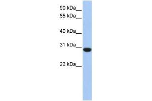 WB Suggested Anti-ASB12 Antibody Titration: 0. (ASB12 抗体  (C-Term))