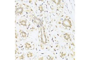 Immunohistochemistry (Paraffin-embedded Sections) (IHC (p)) image for anti-Signal Transducer and Activator of Transcription 1, 91kDa (STAT1) (AA 650-750) antibody (ABIN6148563)