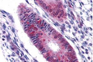 ABIN185199 (2. (DDX5 抗体  (C-Term))