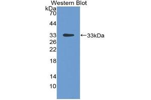 Detection of Recombinant LBP, Rat using Polyclonal Antibody to Lipopolysaccharide Binding Protein (LBP) (LBP 抗体  (AA 226-480))