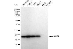 Western blotting analysis using NME1 antibody (ABIN7799617).