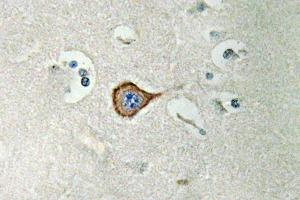 Immunohistochemistry (IHC) analyzes of CNPase antibody in paraffin-embedded human brain tissue. (Cnpase 抗体)