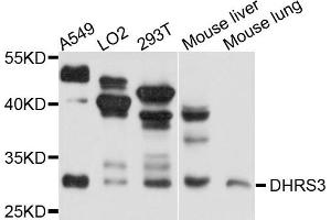 Western blot analysis of extracts of A375 cell line, using DHRS3 antibody. (DHRS3 抗体)